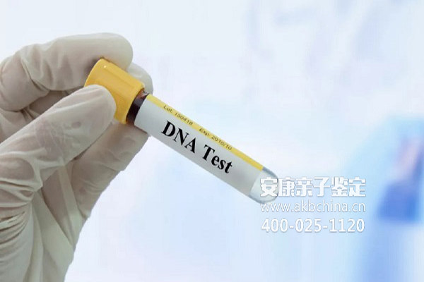 甘肃广东人口普查多少人没DNA 广东DNA亲子鉴定多少钱 
